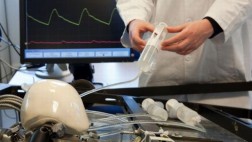 Muere hombre que recibió primer corazón artificial autónomo