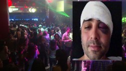 Discoteca Aura sobre agresión: "No podemos retener a nadie"