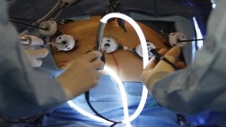 La cirugía para perder peso podría revertir diabetes tipo 2