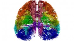 Científicos presentan "mapa" con conexiones del cerebro humano