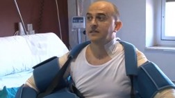 Trasplantan ambos brazos con éxito a paciente en España