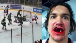 Jugador de hockey pierde 10 dientes y sube su foto al Twitter