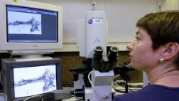 Medicamento Pfizer retrasa avance del cáncer de mamas