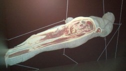 Mira cómo se estudia la anatomía con hologramas de cadáveres