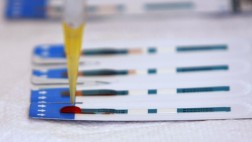 Reino Unido autoriza la autodiagnosis del VIH en el hogar