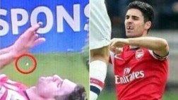 Jugador del Arsenal pierde diente tras choque y sigue jugando