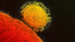 Confirman primer caso de virus MERS en EE.UU.