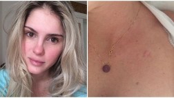 Bárbara Evans, supuesta pareja de Paolo Guerrero, tuvo cáncer