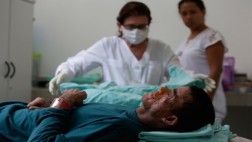 Una rara enfermedad afecta a un pueblo brasileño