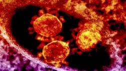 Arabia Saudí reporta cinco muertos más por MERS