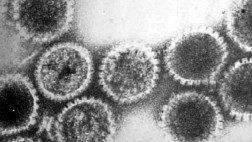 ¿Servirán los virus para combatir los tumores?