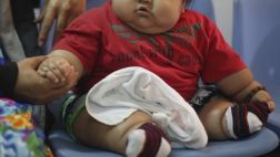 La falta de sueño incrementa el riesgo de obesidad en niños