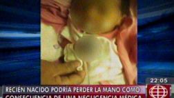Recién nacida podría perder su mano por negligencia médica