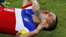 Dempsey anotó el gol más rápido y también le rompieron la nariz