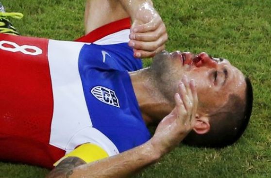 Dempsey anotó el gol más rápido y también le rompieron la nariz