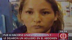 Una mala liposucción le dejó un agujero en abdomen a mujer