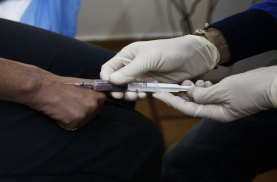 Portadores del VIH son menos propensos a la gripe A