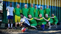 Albino United: el equipo cuya vida peligra cada vez que juega