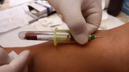 Logran detectar el Alzheimer con solo una prueba de sangre