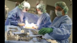 ¿Puede una cirugía para retirar fibromas diseminar el cáncer?