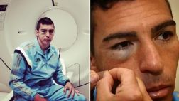 Lucio llamó "cobarde" a jugador que le fracturó hueso facial