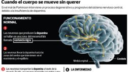 ¿Qué sucede en el cerebro de alguien con el mal de Parkinson?
