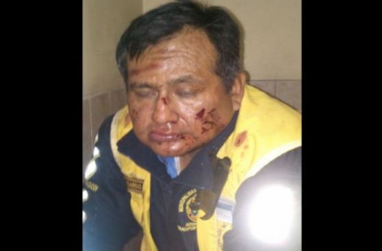 Inspector de la GTU fue brutalmente golpeado tras intervención