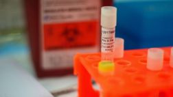 Ébola ha experimentado más de 300 mutaciones