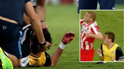 Mandzukic sufrió una fractura en la nariz y será operado mañana