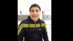 Devuelven la sonrisa a peruanos con malformaciones mandibulares