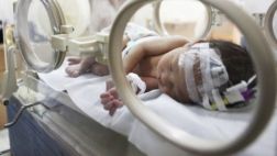 Recién nacida necesita ayuda urgente en Iquitos