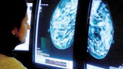 Evolución "darwiniana" vuelve a los tumores más resistentes