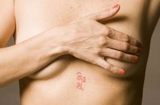 Cáncer de mama: cada año mueren 1.500 mujeres en el Perú