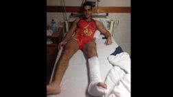 "Combate": así quedó Mario Irivarren tras dolorosa caída