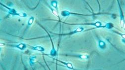 Semen protege al VIH de los antivirales