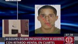 Joven con retardo grave tras golpiza en cuartel de Pueblo Libre