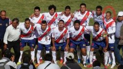 Joao Contreras: jugador tiene quemaduras de segundo grado