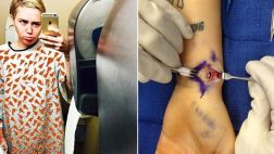 Instagram: Miley Cyrus comparte fotos de su operacion de muñeca
