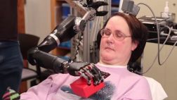 Mujer tetrapléjica usa la mente para controlar brazo robótico