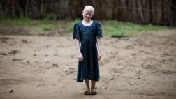 Por qué a los albinos de Tanzania los "matan como a animales"