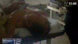 Balacera en hostal: autor de disparos está esposado en hospital
