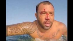 Surf: sufre accidente con la tabla y publica video en Instagram