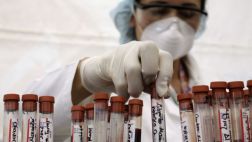 Sustancia experimental contra el sida muestra eficacia en monos