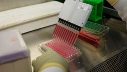 Vacuna experimental contra el VIH será probada en Sudáfrica