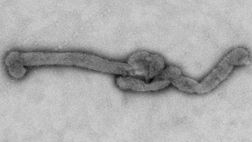 Descubren nuevo virus que ya cobró la vida de un paciente