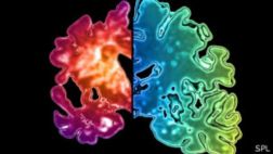 Científicos proponen prueba cutánea para detectar Alzheimer
