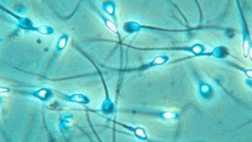 Investigan capacidad protectora del semen de hombres con VIH