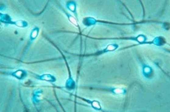 Investigan capacidad protectora del semen de hombres con VIH