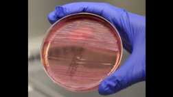 EE.UU.: hallan bacteria mortal en el exterior de un laboratorio