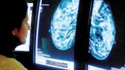 Estudio cuestiona la exactitud de biopsias en cáncer de mama